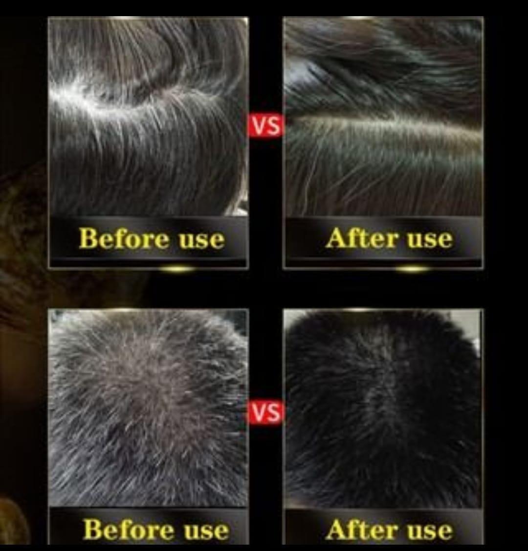 BLOSDREAM Black Hair Shampoo 3 in 1 ( 300ml )